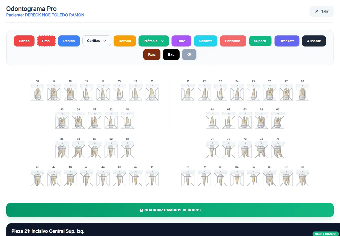 Interfaz de Odontograma Digital MedicinaEcuador Pro